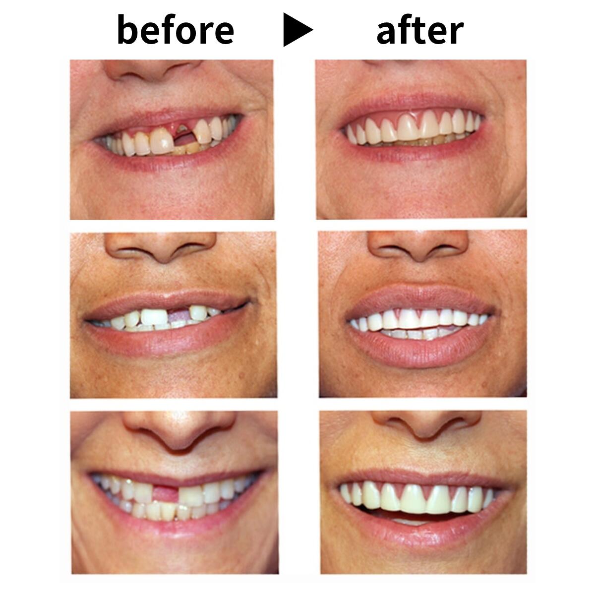 インスタントスマイルDX ミディアム/スモール