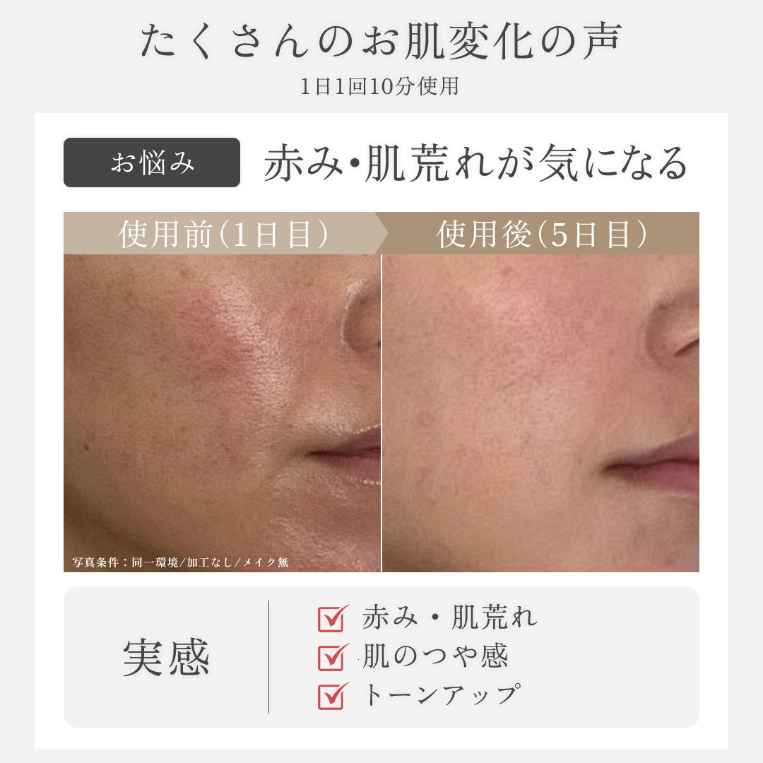 SELINI LDM BOOST PRO 美顔器 セリーニ ジェル不要