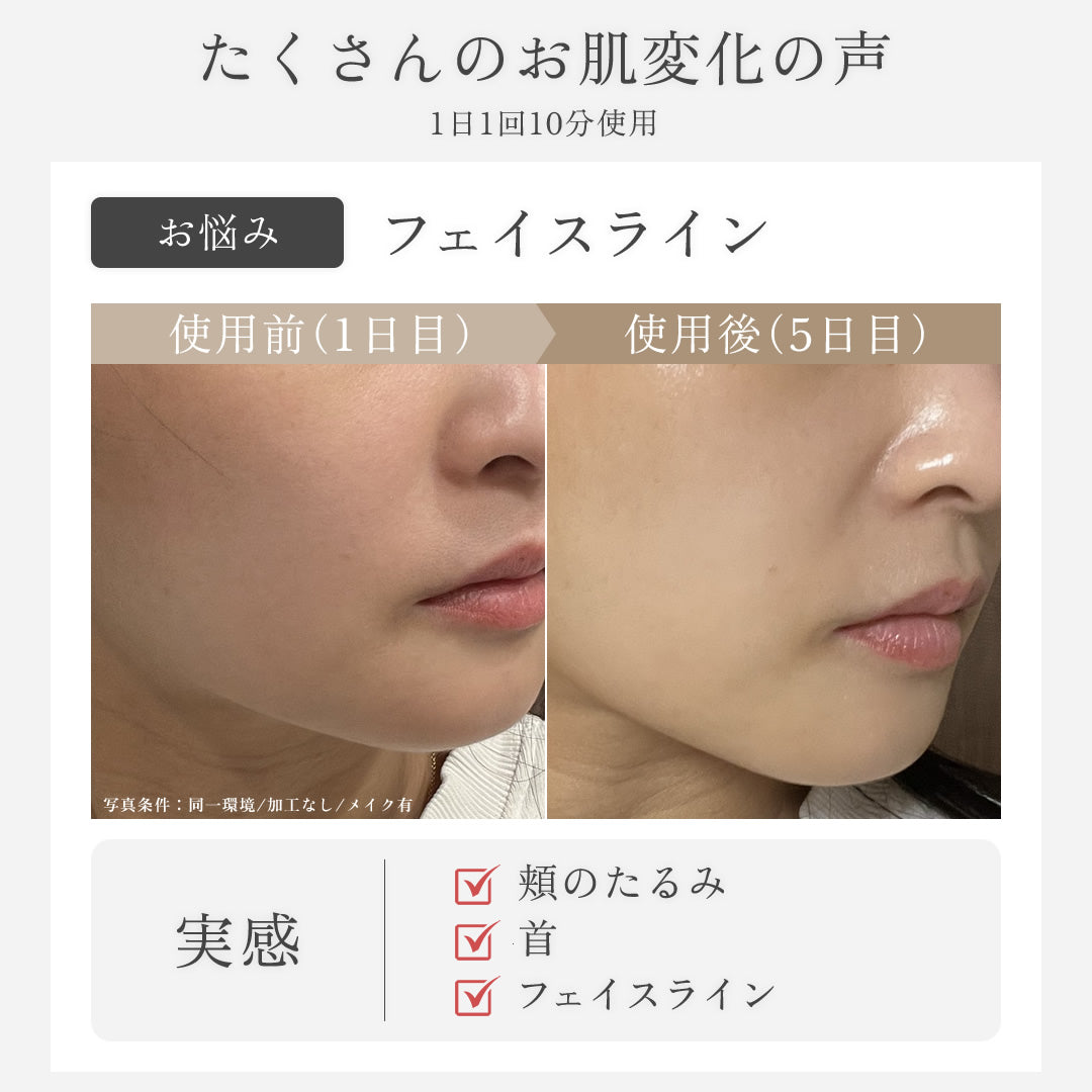SELINI LDM BOOST PRO 美顔器 セリーニ ジェル不要