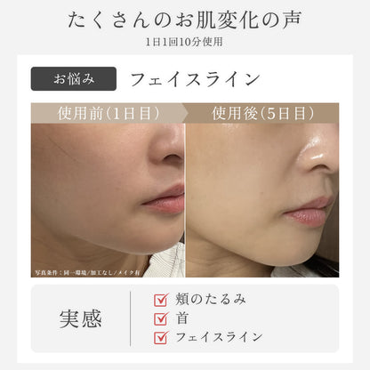 SELINI LDM BOOST PRO 美顔器 セリーニ ジェル不要